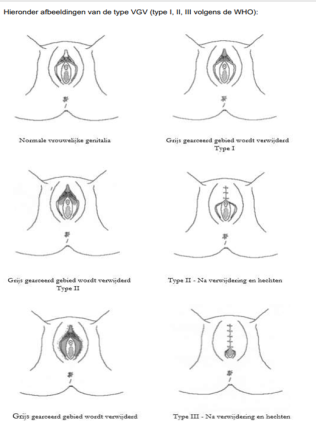 NVOG. (2019). Medische zorg voor vrouwen en meisjes met VGV: Leidraad.