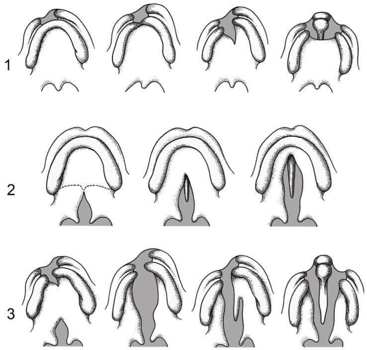 Figuur 2. De verschillende schisistypen van het primaire (eerste) gehemelte (rij 1), het secundaire (tweede) gehemelte (rij 2) en het primaire en secundaire gehemelte (rij 3). Alle tekeningen laten de onderkant van het gehemelte zien (ten Donkelaar e.a., 2014). Rij 1 van links naar rechts: enkelzijdige (in)complete lipspleet; enkelzijdige (in)complete lipspleet met een incomplete kaakspleet; enkelzijdige complete lip-kaakspleet; dubbelzijdige complete lip-kaakspleet. Rij 2 van links naar rechts: een complete spleet van het zachte gehemelte inclusief de huig(de stippellijn geeft de grens aan tussen het harde en zachte gehemelte); een complete spleet van het zachte gehemelte en incomplete spleet van het harde gehemelte; complete spleet van het gehele secundaire (tweede) gehemelte. Rij 3 van links naar rechts: enkelzijdige complete lip-kaakspleet en een complete spleet van de huig en van het zachte gehemelte; enkelzijdige complete lip-kaak-gehemeltespleet; enkelzijdige complete lip-kaak-gehemeltespleet rechts en een incomplete spleet van het harde gehemelte links; dubbelzijdige complete lip-kaak-gehemeltespleet.