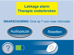 L:\Arts-onderzoekers\Lisanne\Literatuur en protocollen\Protocol\K2 Endospons protocol\Afbeeldingen\Lekkage therapie onderbroken.PNG