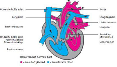 Pulmonalisklepstenose